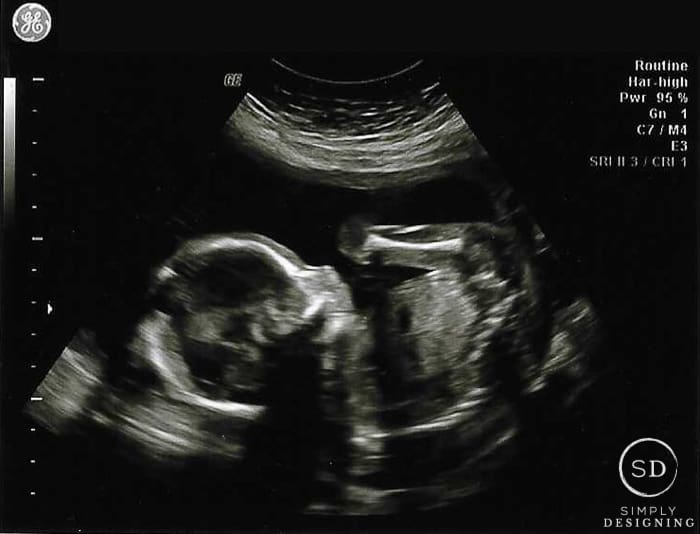 20 week ultrasound 01 Pregnancy #6 : Week 19-20 Update 34 summer dinner party idea